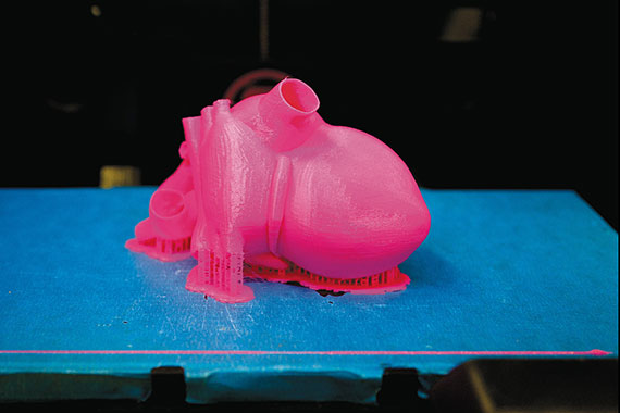 Modelling a Health Heart